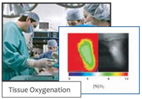 2D Sensor Imaging Foils (VisiSensTM) for O2, pH, and CO2
